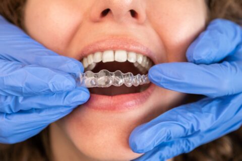 Invisalign Dentist Boynton Beach