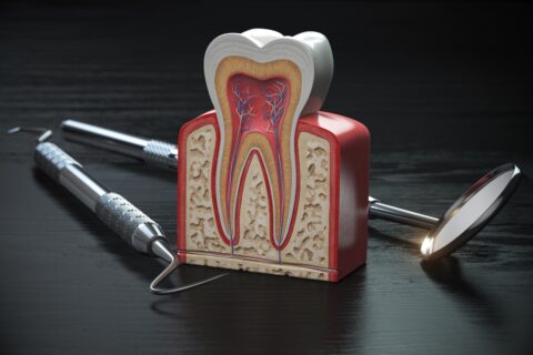 Root Canal Treatment Boynton Beach