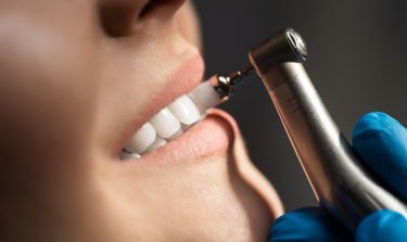 The Benefits Of Dental Cleanings Beyond Just Clean Teeth