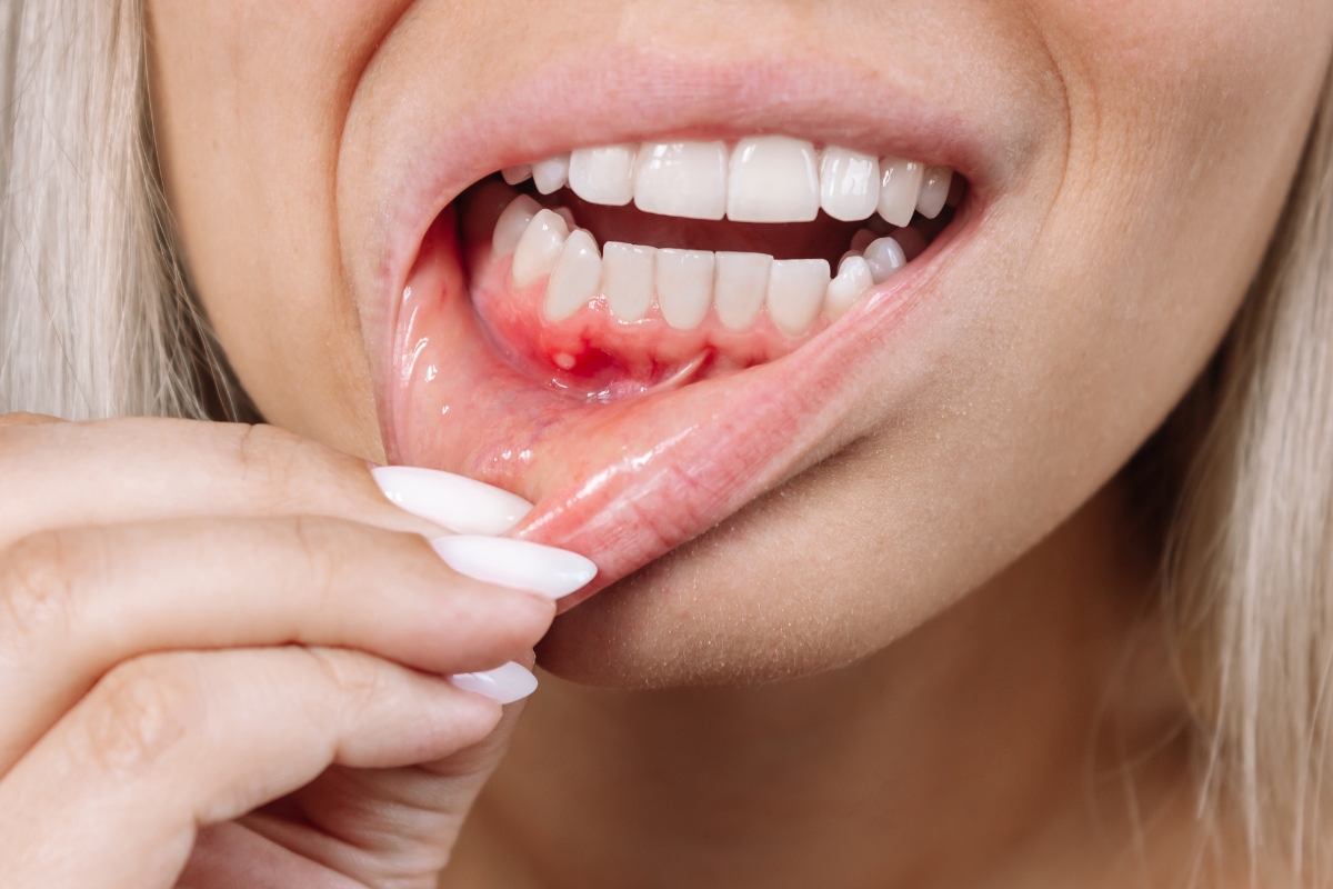 How Vaping Affects Your Gums? A Guide By Town Square Dentistry