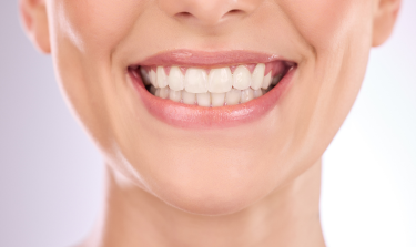 Why Professional Teeth Whitening Is Worth The Investment? Top   Oral Benefits