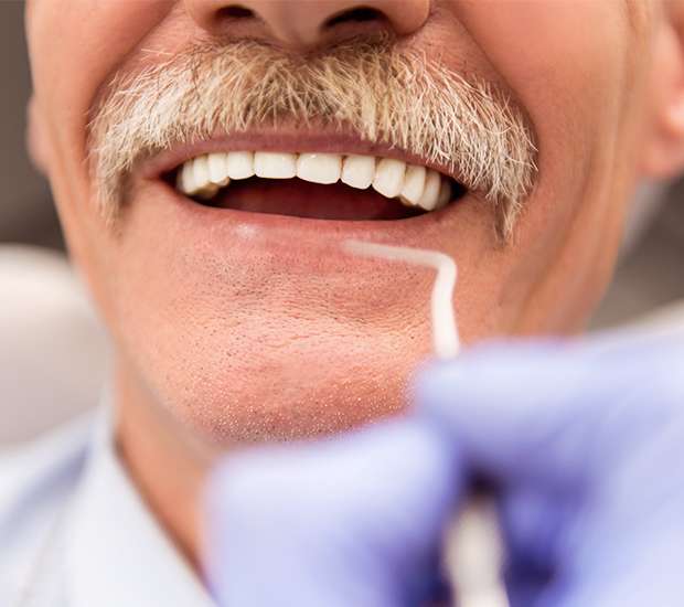 Boynton Beach Adjusting to New Dentures