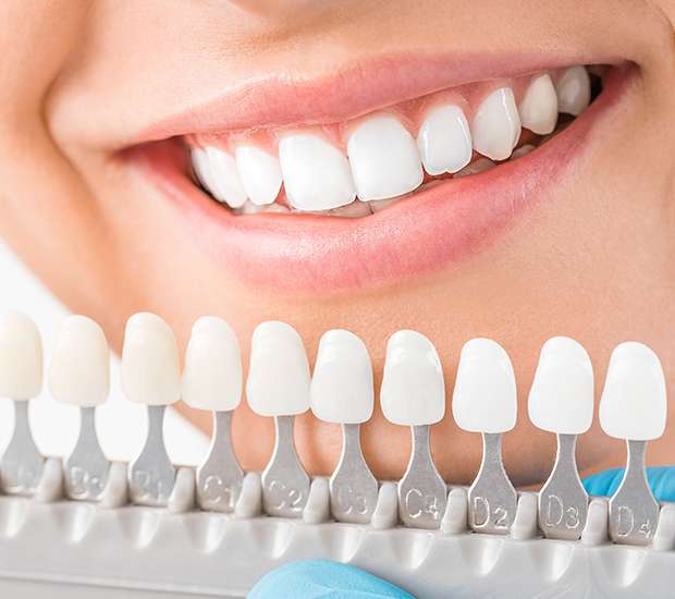Boynton Beach Cosmetic Dentist