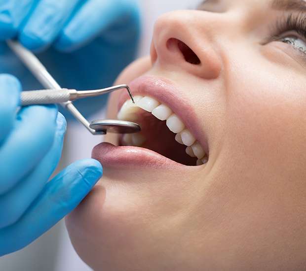 Boynton Beach Dental Bonding