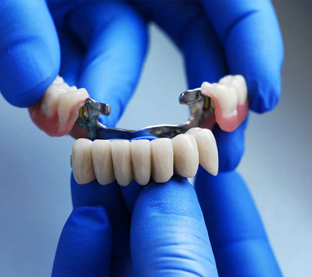 Boynton Beach Dental Bridges