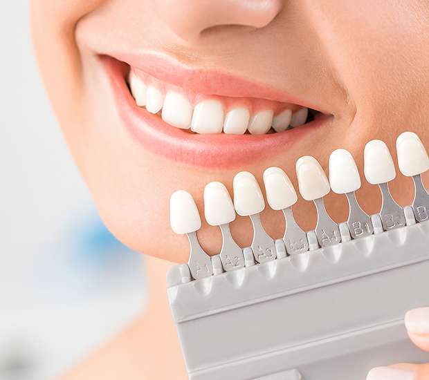 Dental Laminates Vs Veneers: Which One Is Right For You?