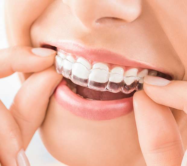 Boynton Beach Does Invisalign Really Work