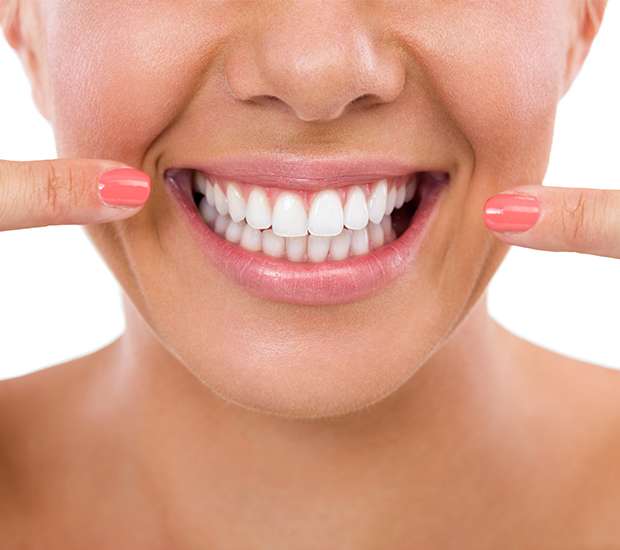 Boynton Beach What Is Gum Contouring & Reshaping