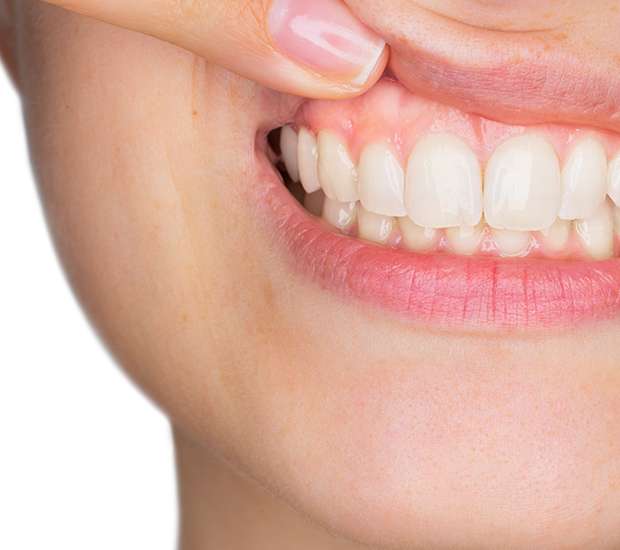 Boynton Beach Gum Disease
