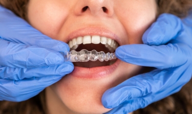 How Lifestyle Choices Affect Your Invisalign Treatment In Boynton Beach?