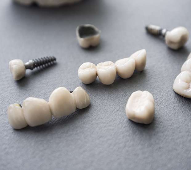 Boynton Beach The Difference Between Dental Implants and Mini Dental Implants