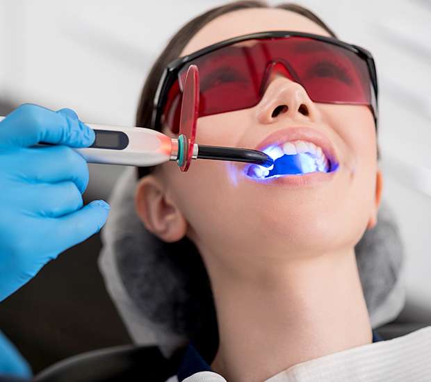 Boynton Beach Professional Teeth Whitening