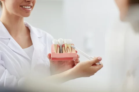 dental implants in boynton beach