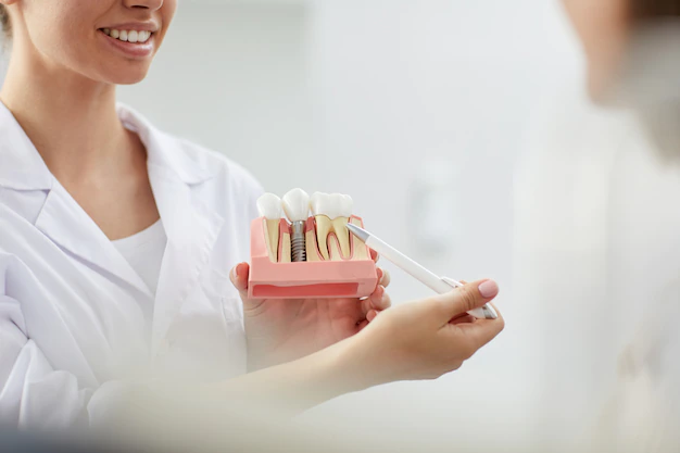 dental implants in boynton beach