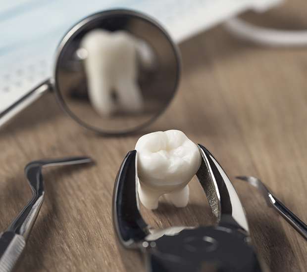 Boynton Beach When Is a Tooth Extraction Necessary